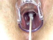 gyno students 18+