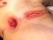 Young Tart Tries First Time Anal Gaping